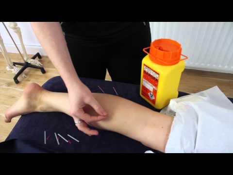 Louth Physiotherapy Infomercial