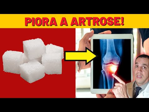 ARTHRITIS AND OSTEOARTHRITIS - CAN SUGAR MAKE OSTEOARTHRITIS WORSE?