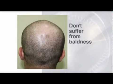 Australian Institute of Hair Restoration TV Commercial