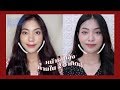 เมโสแฟต ยี่ห้อไหนดี