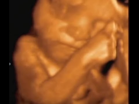 What do babies do in the womb? Incredible 4D scan of FETUS eating, crying and SNEEZING!