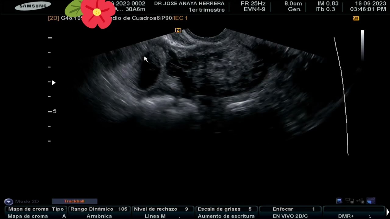 José Anaya Herrera-8