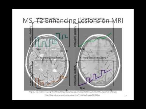 Neuro Infection, Autoimmune Disorders, and Neuropathies