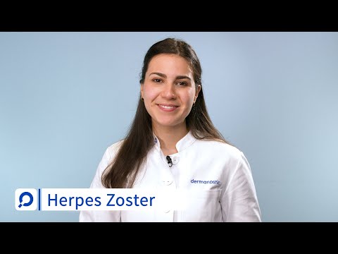 Herpes Zoster (Shingles) - Causes, Symptoms and Treatment | dermanostic Skin Encyclopedia