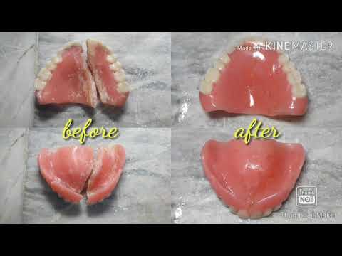 How to repair and clean a fractured complete  upper denture
