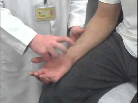 Tinel's Test of the Ulnar Tunnel