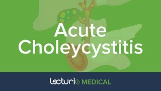 Acute Choleycystitis Overview and Practice Case | Gastroenterology