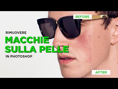 Lentiggine di bambola di primavera 15 La crema per il viso con pigmentary nota per la primavera