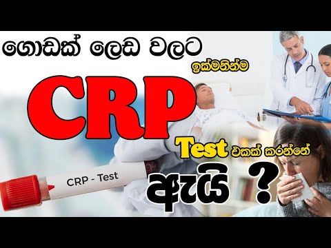CRP Report | CRP Test  එකක් කරන්නේ ඇයි | C- Reactive Protein | sinhala