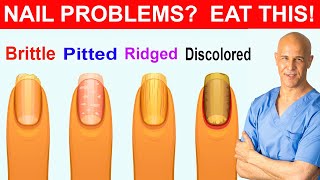 NAIL PROBLEMS ?  EAT THIS !    Dr. Mandell