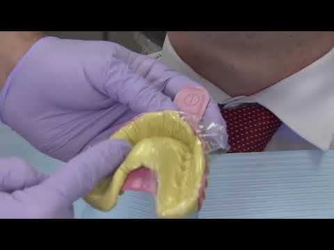 Case of the Week #96: Bonding to Zirconia
