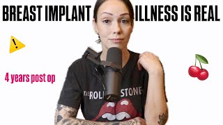 I am removing my implants ...