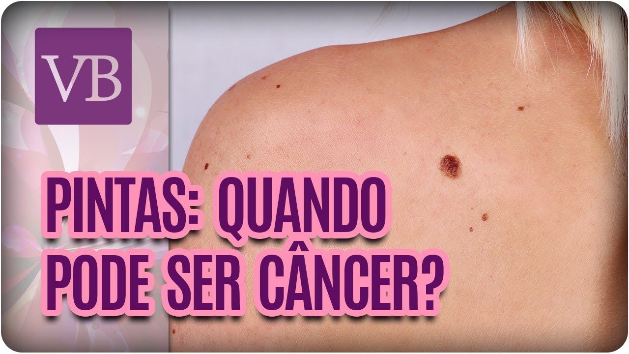 Pintas: Como Saber Se É Câncer - Você Bonita (30/10/17)