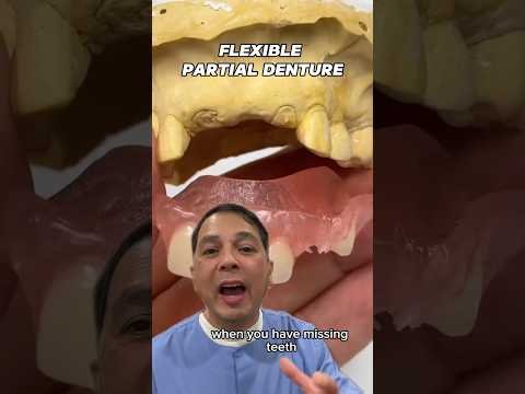 Replacing Missing Front Teeth With Flexible Partial Denture | View Mobile Dental #shorts