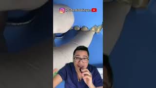 ❌ lo que NO DEBES HACER con CARILLAS DENTALES ❌ 👀