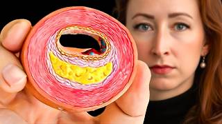 3 Things I Avoid as a Vascular Surgeon (It Clogs Arteries Fast!)