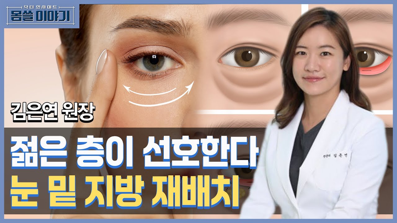 눈 밑 개선을 위한 지방 재배치 안전할까? [몸쓸이야기 7회]