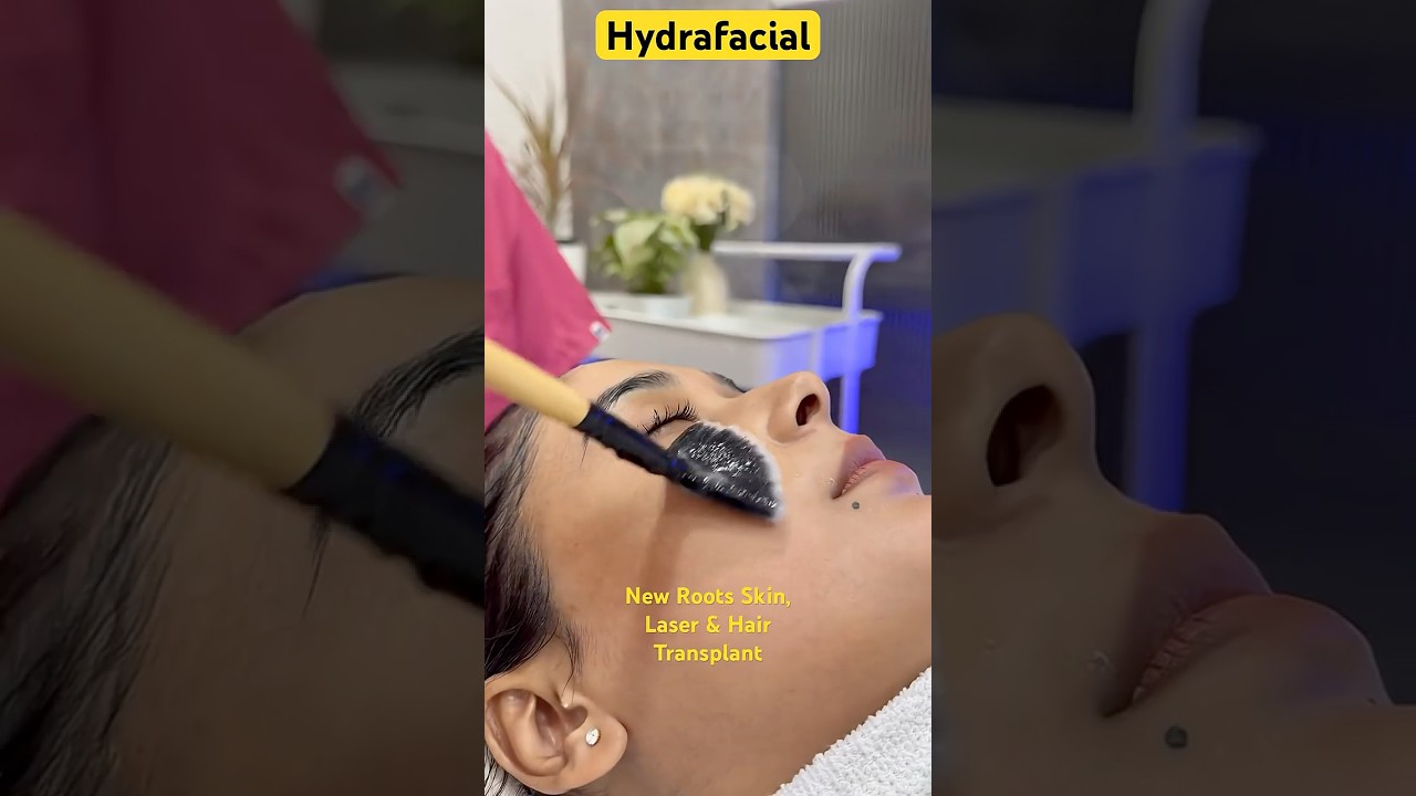 Get glowing skin with Hydrafacial at New Roots Skin, Laser & Hair Transplant Clinic!  #Hydrafacial