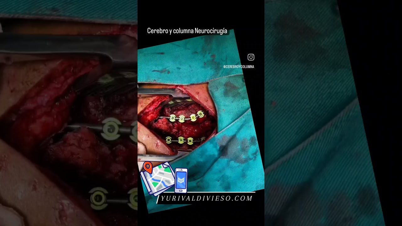 Yuri Vladimir Valdivieso Villena-18