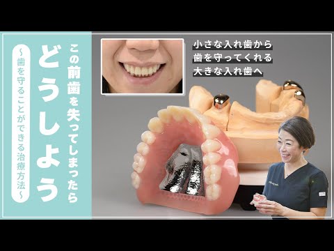 この前歯を失ってしまったらどうしよう〜歯を守ることができる治療方法〜