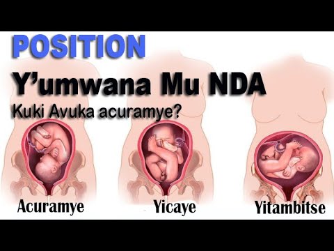 POSITION Y UMWANA MUNDA! Kuki avuka Acuramye? IMPAMVU zatuma yitambika cg akavuka yicaye!