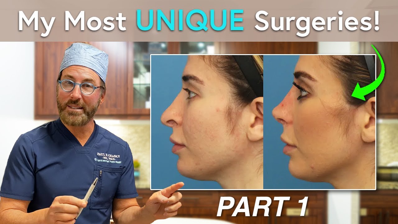The Most UNIQUE Surgical Cases I’ve Performed