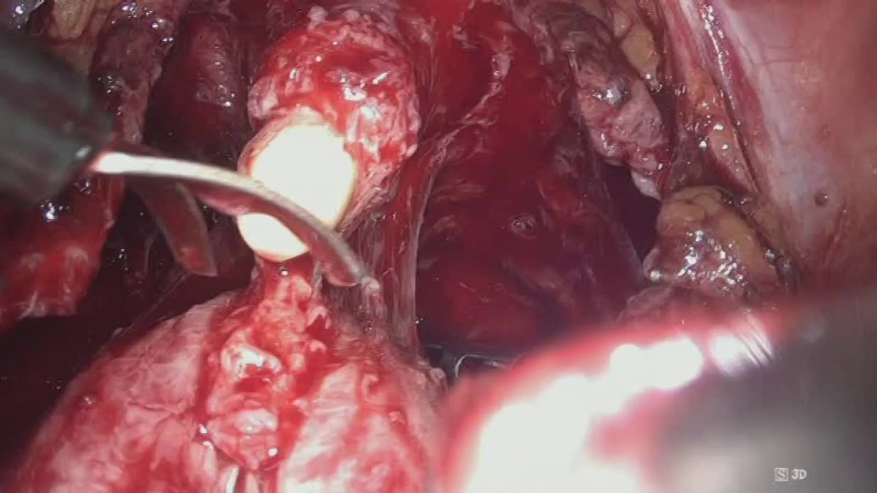 Francesco Chiaradia-7