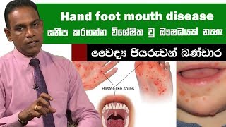 Hand foot mouth disease සනීප කරගන්න විශේෂිත වු ඖෂධයක් නැහැ | Piyum Vila | 24-06-2019 | Siyatha TV
