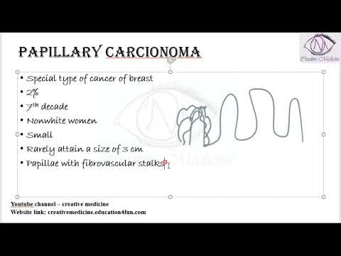 Lec 26 Carcinoma Breast   Papillary Carcinoma || Breast