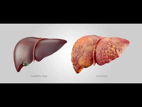 35 Hz : Liver (RIFE Healing Frequency)