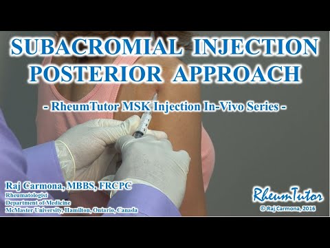 SUBACROMIAL SHOULDER INJECTION POSTERIOR APPROACH - Step-By-Step Procedure