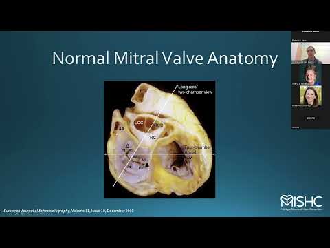 Dr. Andrew Harris presents "Mitral Valve Echocardiographic Assessment for TEER and TMVR Procedures"