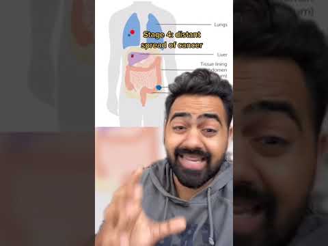 What happened to Chadwick Boseman? #shorts