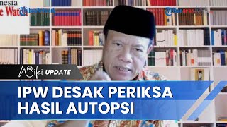 IPW Minta Tim Khusus Bentukan Listyo Sigit Periksa Hasil Autopsi Jenazah Brigadir J, Ini Tujuannya