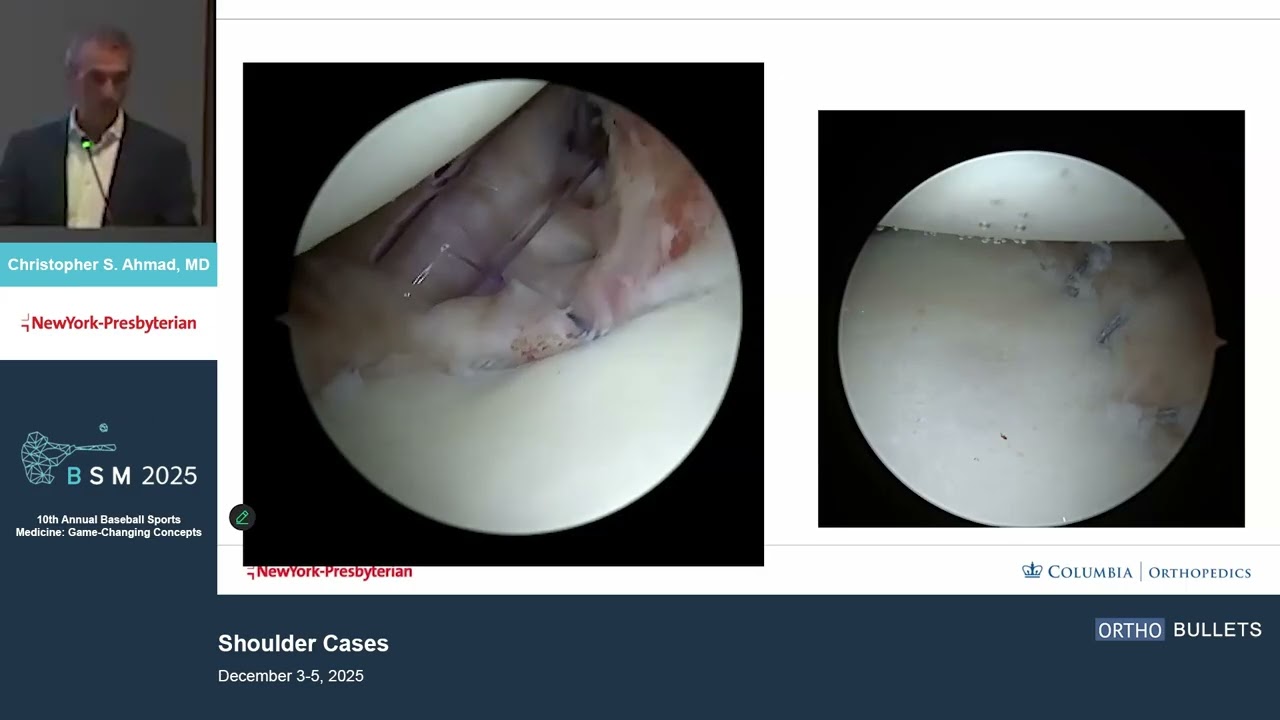 Shoulder Cases_Full Panel_Moderated by Christopher S. Ahmad MD