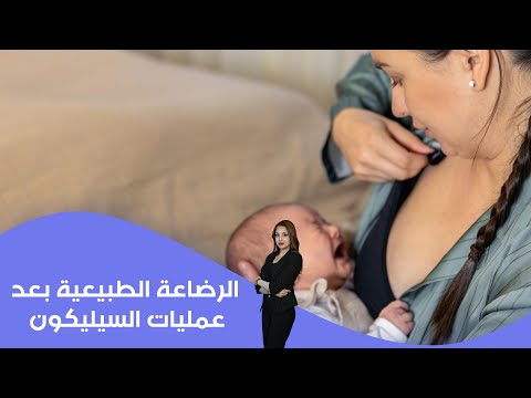 فيديو | الرضاعة الطبيعية بعد عمليات السيليكون
