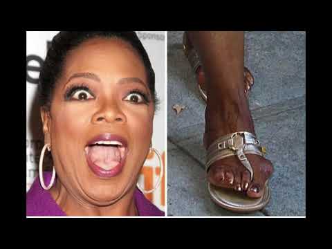 TOP 10 UGLY CELEBRITY FEET PT1!!!!  YUCK!