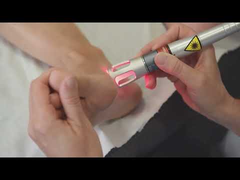 Protocollo e trattamento K LASER per patologia dell'alluce valgo