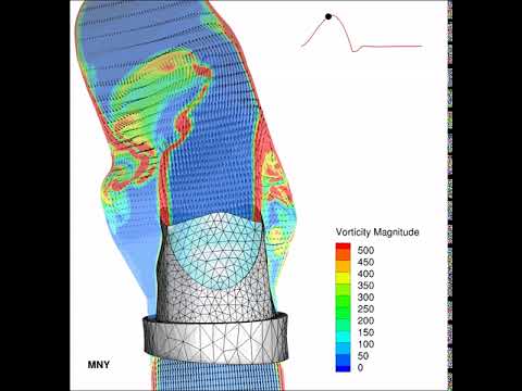 Aortic Heart Valve FSI