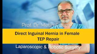 Miniaturka - Direct Inginal Hernia in Female.TEP Repair .Metin Ertem MD.FACS