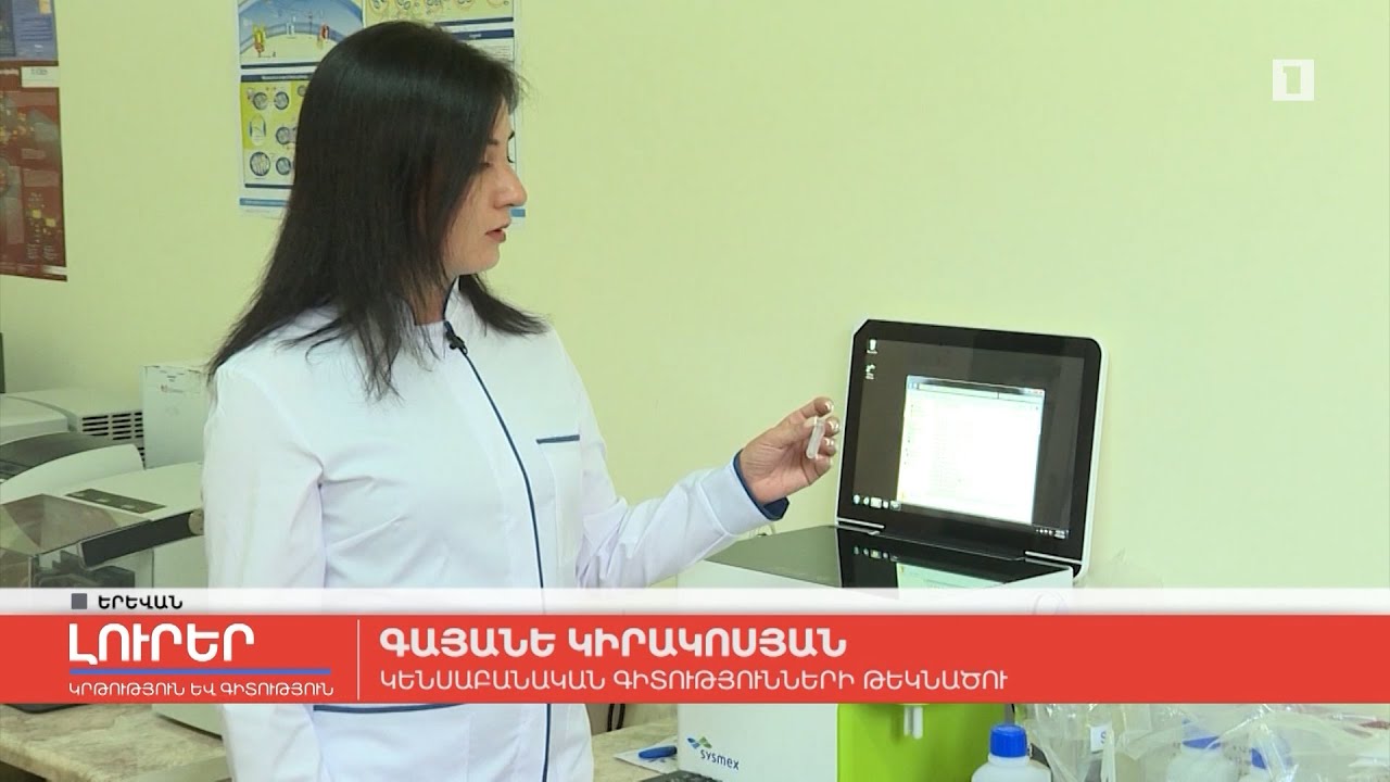 Հայ գիտնականները ստեղծել են օձի հակաթույն