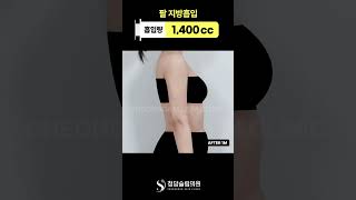 팔 고민, 진짜 정리할 때 됨 👀