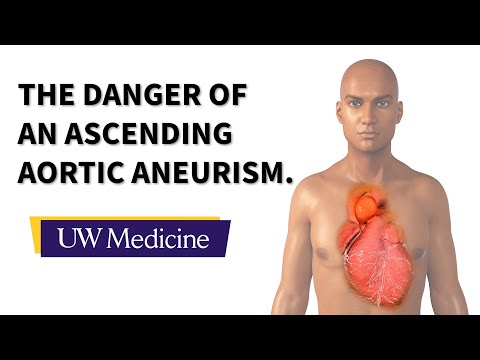 Surgeon describes an ascending aortic aneurysm | UW Medicine