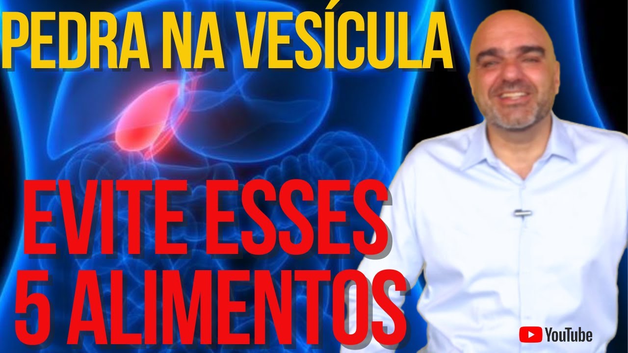 EVITE esses alimentos se você tem PEDRA NA VESÍCULA