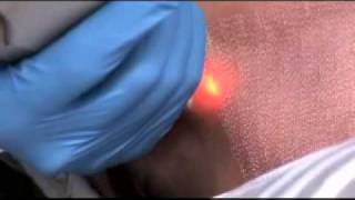 ActiveFx at Ailesbury Clinic