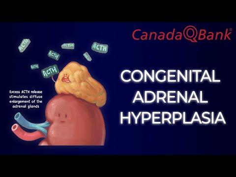 Congenital Adrenal Hyperplasia