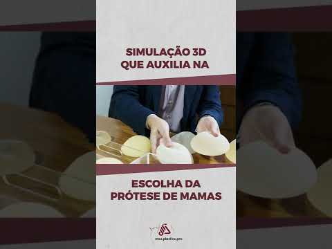 Simulação 3D para Prótese Mamária