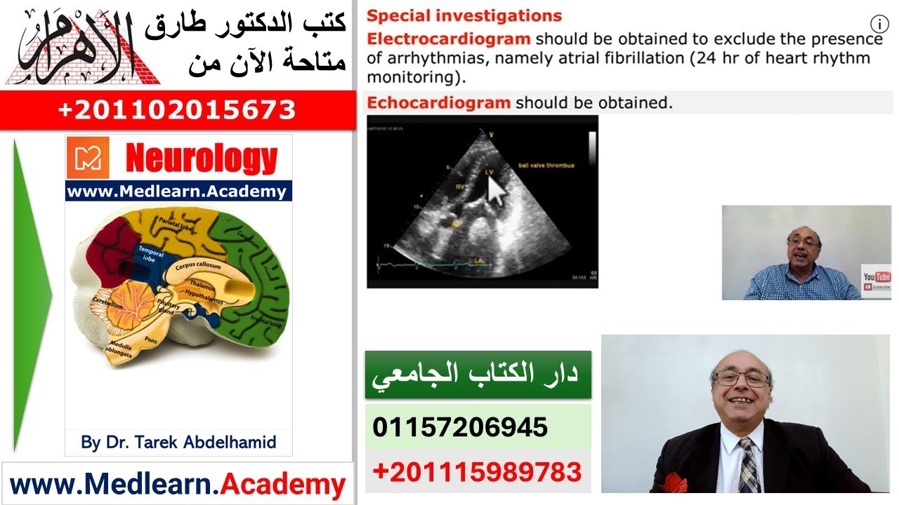 Transient Ischemic Attacks TIA (Part 2)