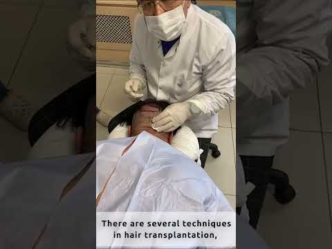 INVICTUS - DHI Technique in Hair Transplantation