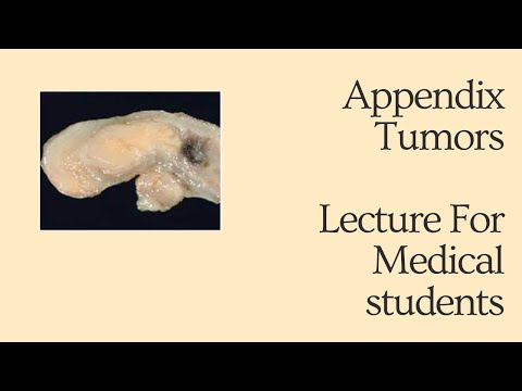 Appendix tumors - Lecture for Medical Students  #mbbs #neet #usmle #fmge #neetpg